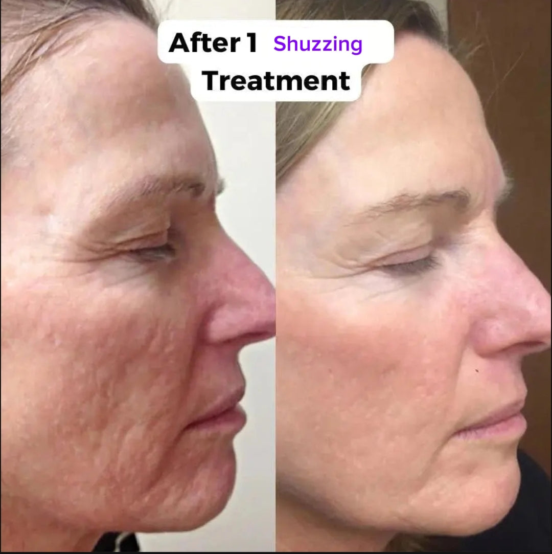 YouthDrop – Reduce Wrinkles & Revive Skin