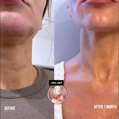 YouthDrop – Reduce Wrinkles & Revive Skin